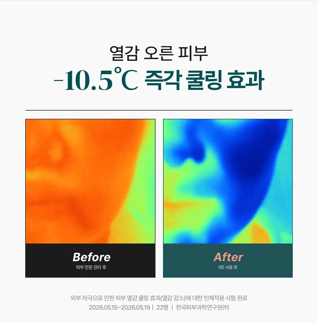 [전문 드레싱 관리_거즈 마스크]리쥬덱스 더마 리페어링 드레싱 마스크 1매 상세페이지 16